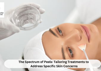 The Spectrum of Peels: Tailoring Treatments to Address Specific Skin Concerns