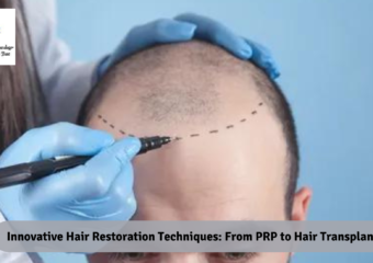 Innovative Hair Restoration Techniques: From PRP to Hair Transplants