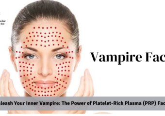 Unleash Your Inner Vampire: The Power of Platelet-Rich Plasma (PRP) Facials