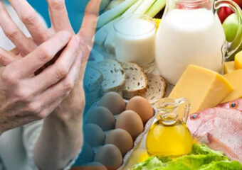 Joint Pain and Diet: How Nutrition Can Help Manage Arthritis