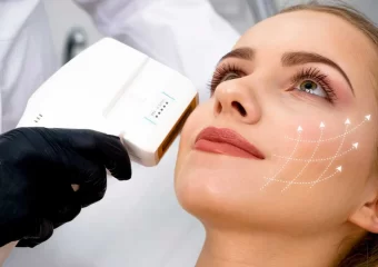 High-Intensity Focused Ultrasound (HIFU): A Revolutionary Non-Invasive Cosmetic Treatment